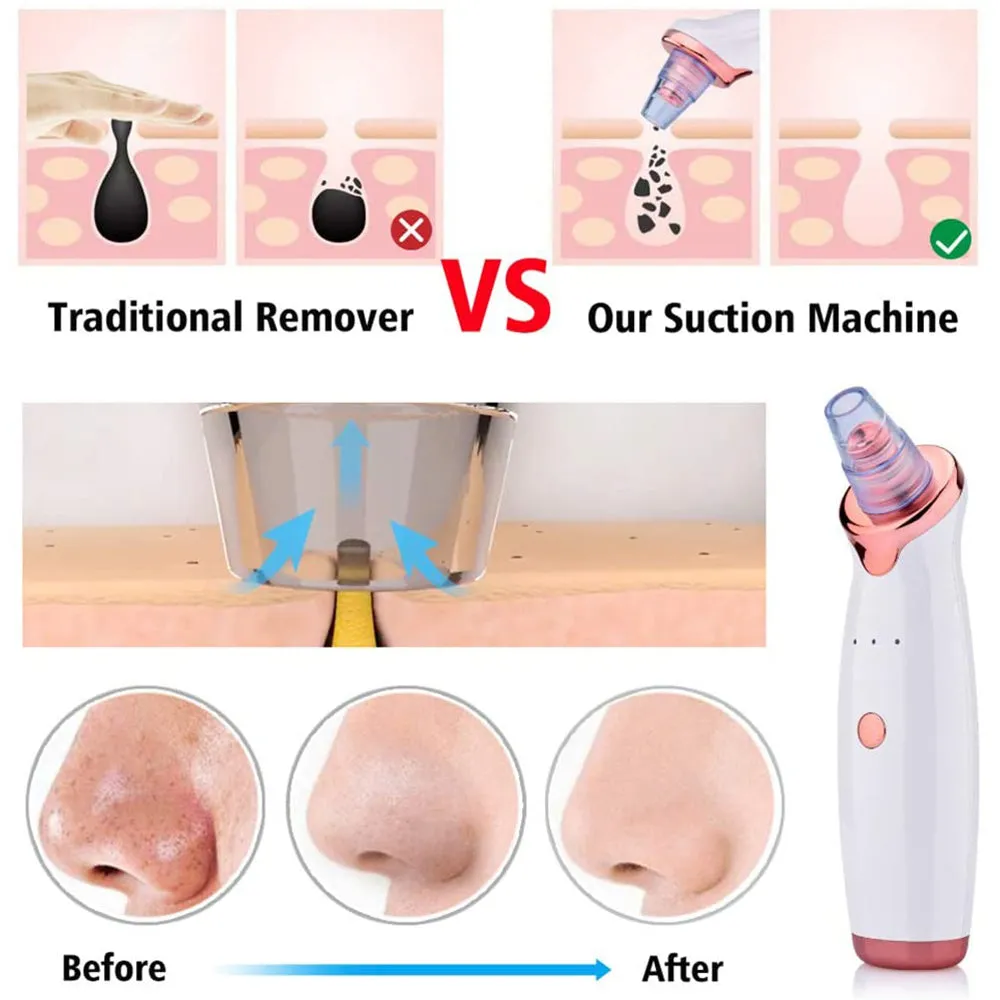 Acne Pimple Blackhead Remover Deep Cleaner fo Face- USB Charging